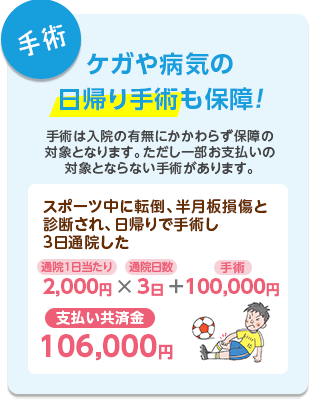 【手術】ケガや病気の日帰り手術も保障！　手術は入院の有無にかかわらず保障の対象となります。ただし一部お支払いの対象とならない手術があります。スポーツ中に転倒、半月板損傷と診断され、日帰りで手術し3日通院した　通院1日当たり2,000円×通院日数3日＋手術100,000円：支払い共済金106,000円