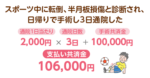 スポーツ中に転倒、半月板損傷と診断され、日帰りで手術し3日通院した　通院1日当たり2,000円×通院日数3日＋手術共済金100,000円：支払い共済金106,000円