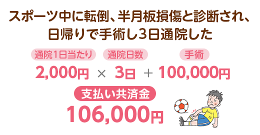 スポーツ中に転倒、半月板損傷と診断され、日帰りで手術し3日通院した　通院1日当たり2,000円×通院日数3日＋手術100,000円：支払い共済金106,000円